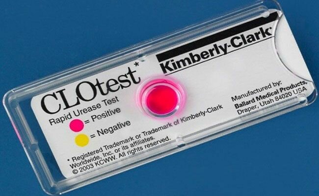 CLO-test dương tính là gì?