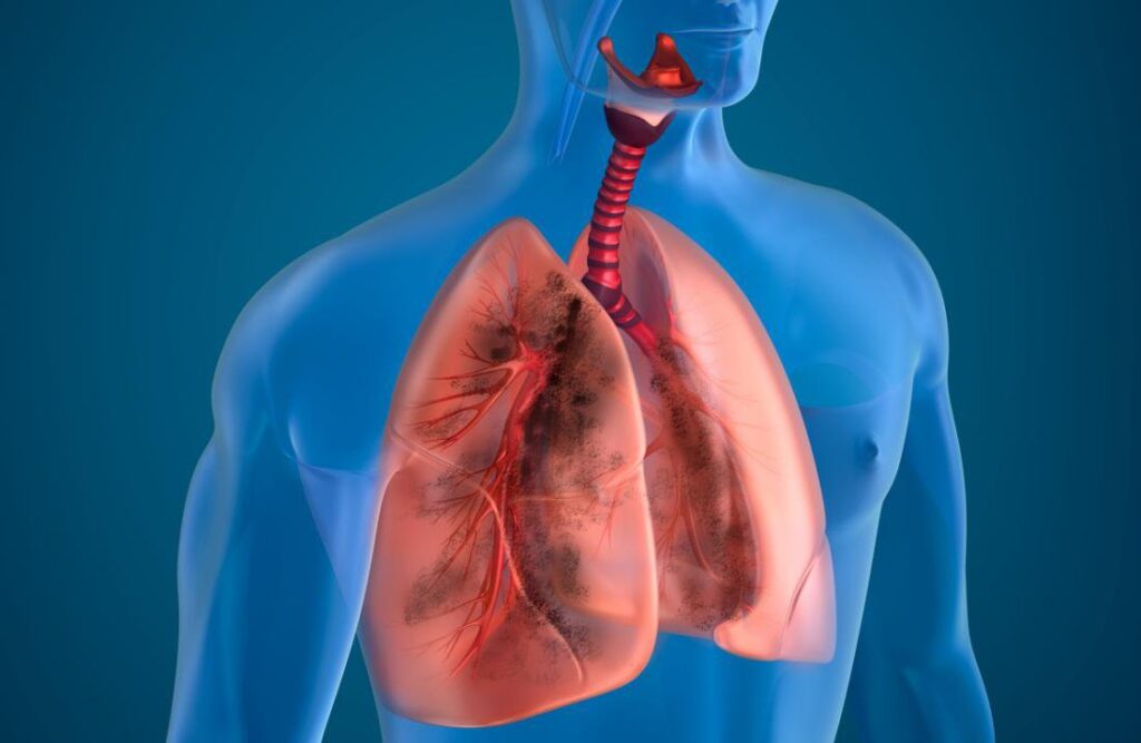 Hút thuốc lá có hại như thế nào cho hệ hô hấp?
