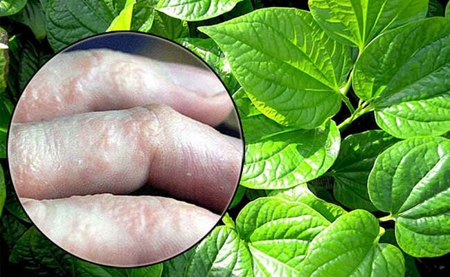 Chữa thoái hóa cột sống bằng lá lốt