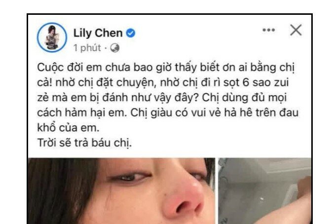 Lily Chen bị hành hung, gương mặt nhiều thương tích?