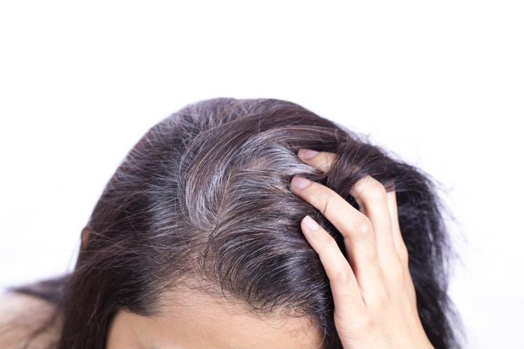 Nguyên nhân tóc bạc sớm ở nữ giới