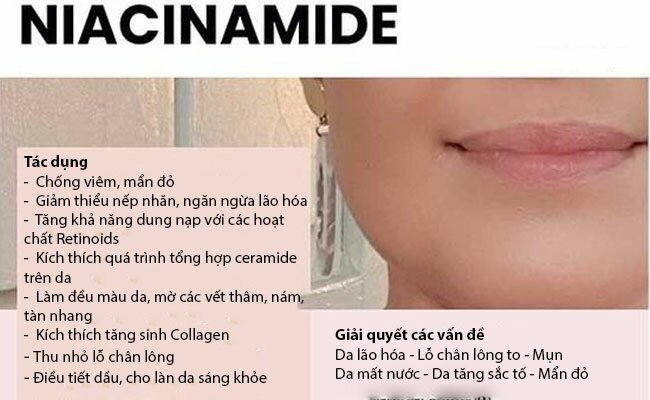 Niacinamide trị mụn có tốt không?