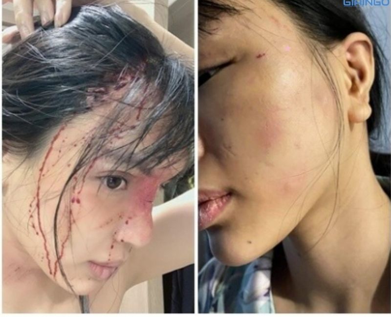 Người mẫu Khả Trang Trang bị chồng sắp cưới giam lỏng, bạo hành?