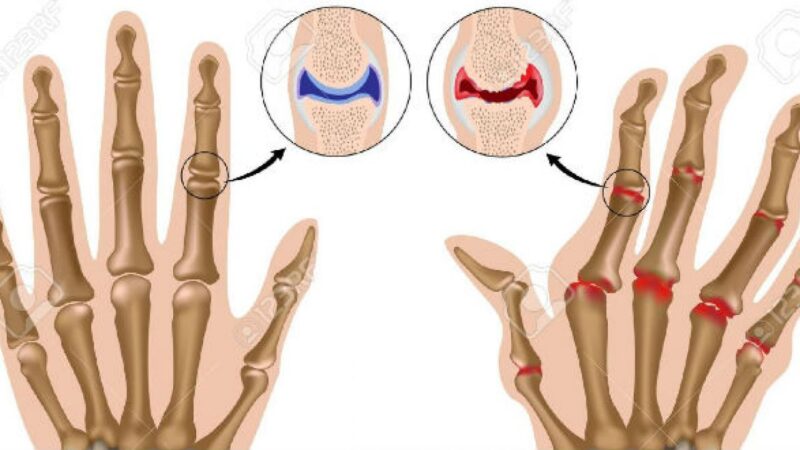 Sự khác nhau giữa xương tay và xương chân có ý nghĩa gì đối với hoạt động của con người?