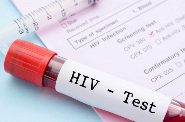 16 triệu chứng HIV bạn cần biết