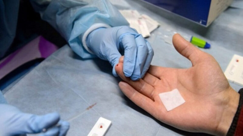 Xét nghiệm HIV bao lâu có kết quả?