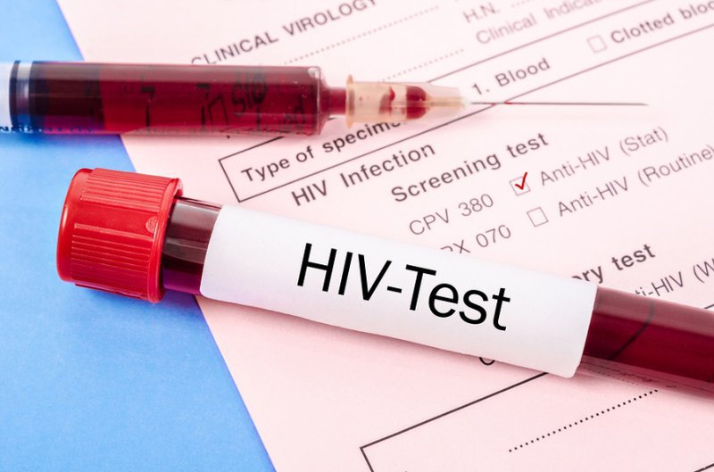 Xét nghiệm HIV 3 tháng âm tính 6 tháng dương tính